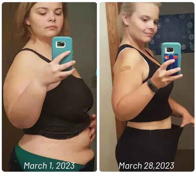 Dobshow™ Bee Venom Slimming Patches