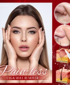 Dobshow™ Pigmaclean Tags & Mole Remover