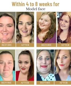 Dobshow™ slimming patches with bee venom