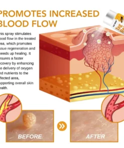 EAST MOON™Bee Venom Lymphatic Drainage Slimming Patch