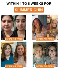 EAST MOON™Bee Venom Lymphatic Drainage Slimming Patch