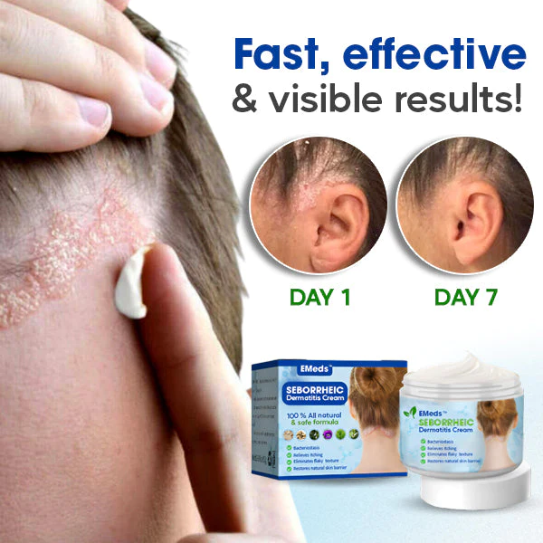 EMeds™ Seborrheic Dermatitis Cream - Image 3