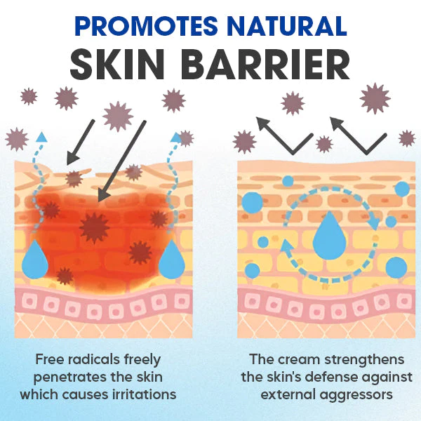 EMeds™ Seborrheic Dermatitis Cream - Image 4