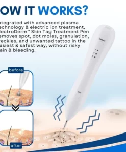 ElectroDerm™ Skin Tag Treatment Pen