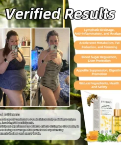 Fivfivgo™ Bee Venom Intestinal Detox Belly Button Drops