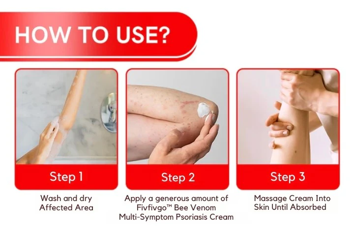 Fivfivgo™ Bee Venom Multi-Symptom Psoriasis Cream