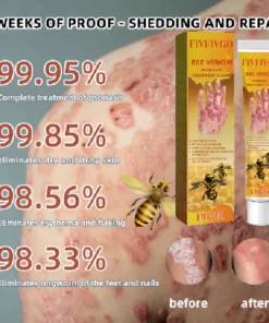 Fivfivgo™ Bee Venom Psoriasis Treatment Cream