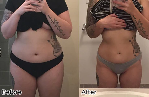 Fivfivgo™ BeeVenom Abnehmendes Fußpflaster