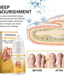 Fivfivgo™ BeeVenom Nagelpilz Lösung