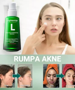 Fivfivgo™ Body Acne Serum