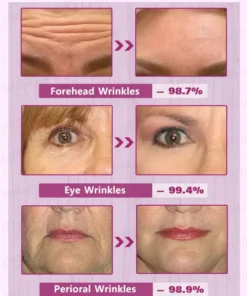 Fivfivgo™ Botox-Gesichtsserum