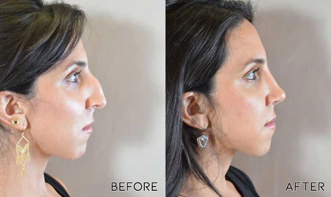 Fivfivgo™ Nose Defining Serum