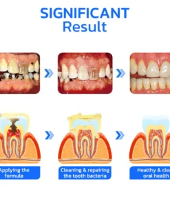 Fivfivgo™ Propolis-Sofortbehandlungsspray zum Einnehmen
