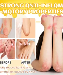 Fivfivgo™ PsoriX Bienengift-Creme