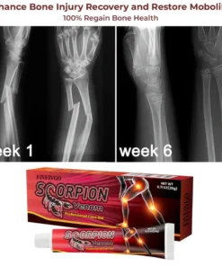 Fivfivgo™ Skorpiongift Professionelles Pflegegel