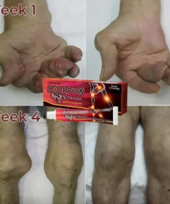 Fivfivgo™ Skorpiongift Professionelles Pflegegel