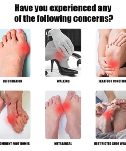 FlexBun™ Adjustable Painless Bunion Splint Corrector