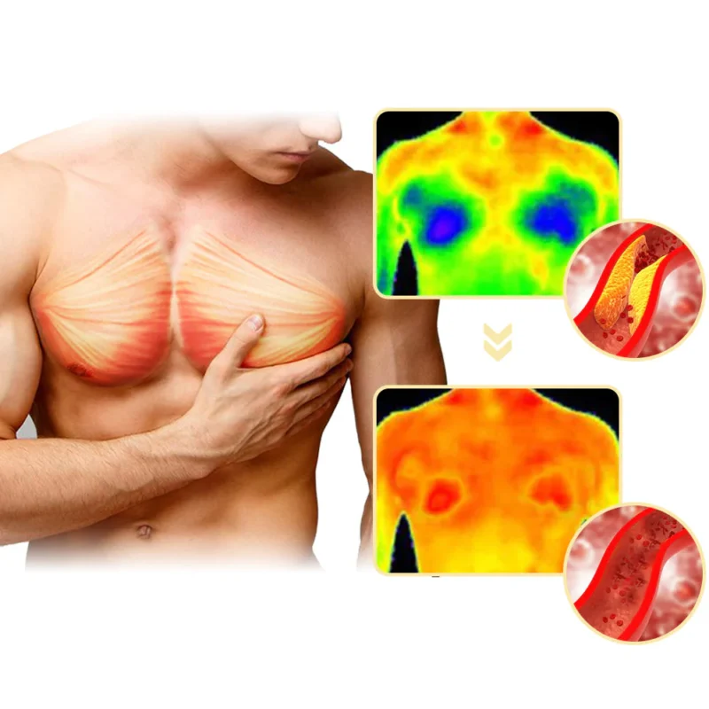 Furzero™ MenRobust Bee Venom Gynecomastia Varmeolie