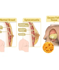 Furzero™ MenRobust Bee Venom Gynecomastia Varmeolie