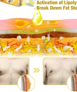 Furzero™ MenRobust Bee Venom Gynecomastia Varmeolie