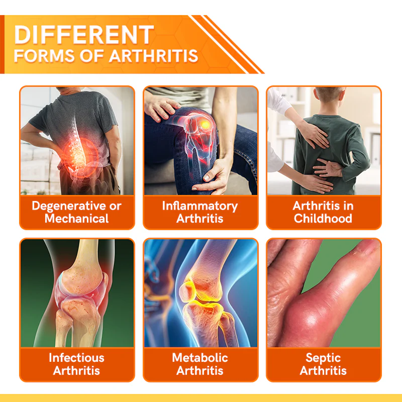 Furzero™ Bee Venom Joint Therapy Pain Relief Gel