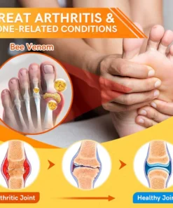 Furzero™ Bee Venom Joint Therapy Pain Relief Gel