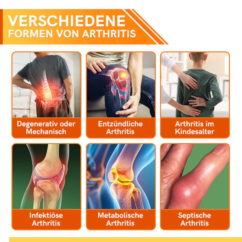 Furzero™ Bienengift Joint Therapy Schmerzlinderungsgel