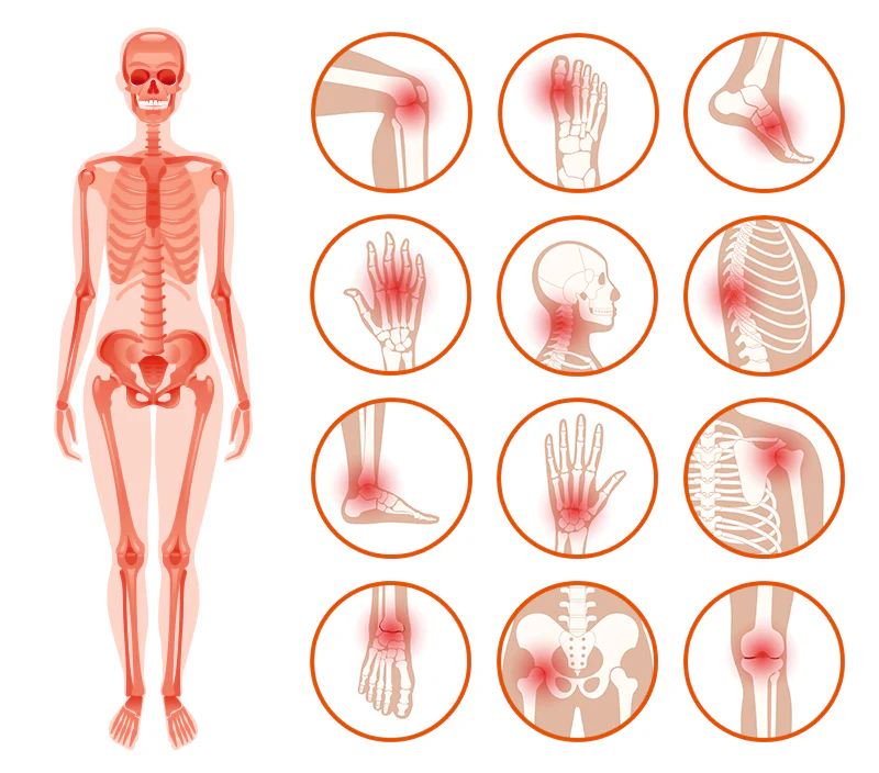 Furzero™ Bienengift Joint Therapy Schmerzlinderungsgel
