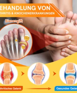 Furzero™ Bienengift Joint Therapy Schmerzlinderungsgel