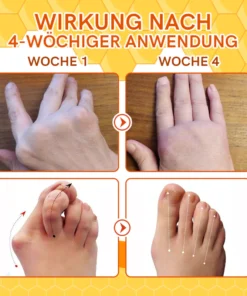 Furzero™ Bienengift Joint Therapy Schmerzlinderungsgel