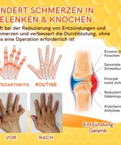 Furzero™ Bienengift Joint Therapy Schmerzlinderungsgel