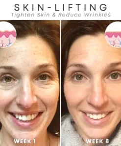 Furzero™ Botox Facial Essence