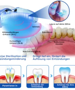 Furzero™ Laser-Behandlungsgerät für Zahnfleischerkrankungen