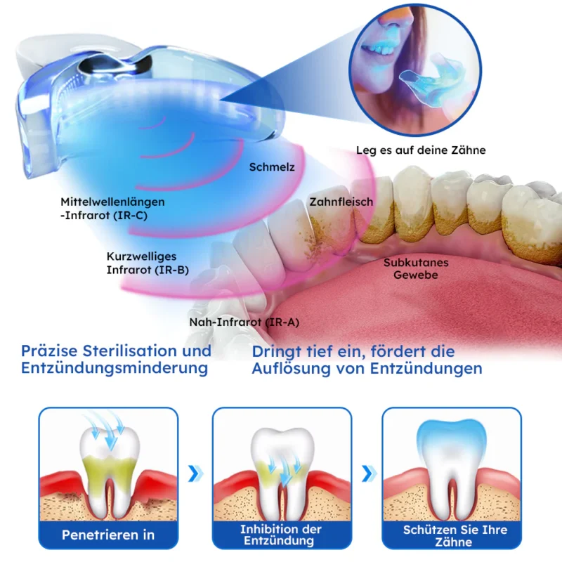 Furzero™ Laser-Behandlungsgerät für Zahnfleischerkrankungen