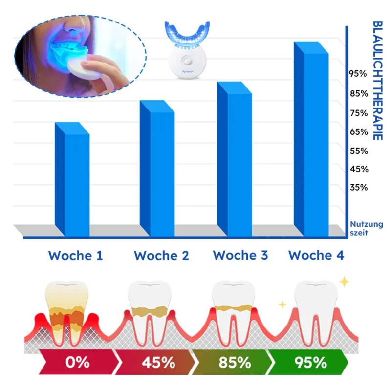 Furzero™ Laser-Behandlungsgerät für Zahnfleischerkrankungen
