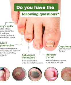 Furzero™ Medi-Care Anti-Fungal Stick