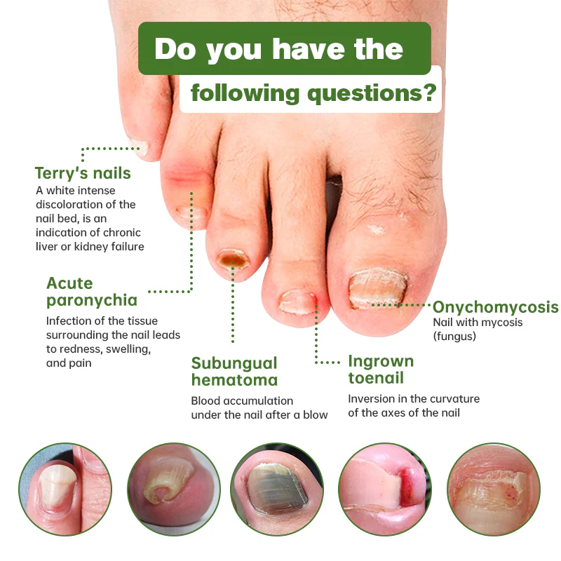 Furzero™ Medi-Care Anti-Fungal Stick