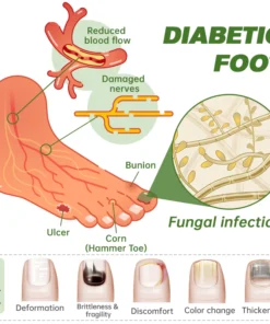 Furzero™ Medi-Care Anti-Fungal Stick