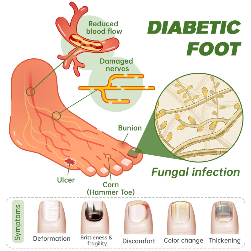 Furzero™ Medi-Care Anti-Fungal Stick