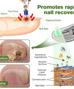 Furzero™ Medi-Care Anti-Fungal Stick