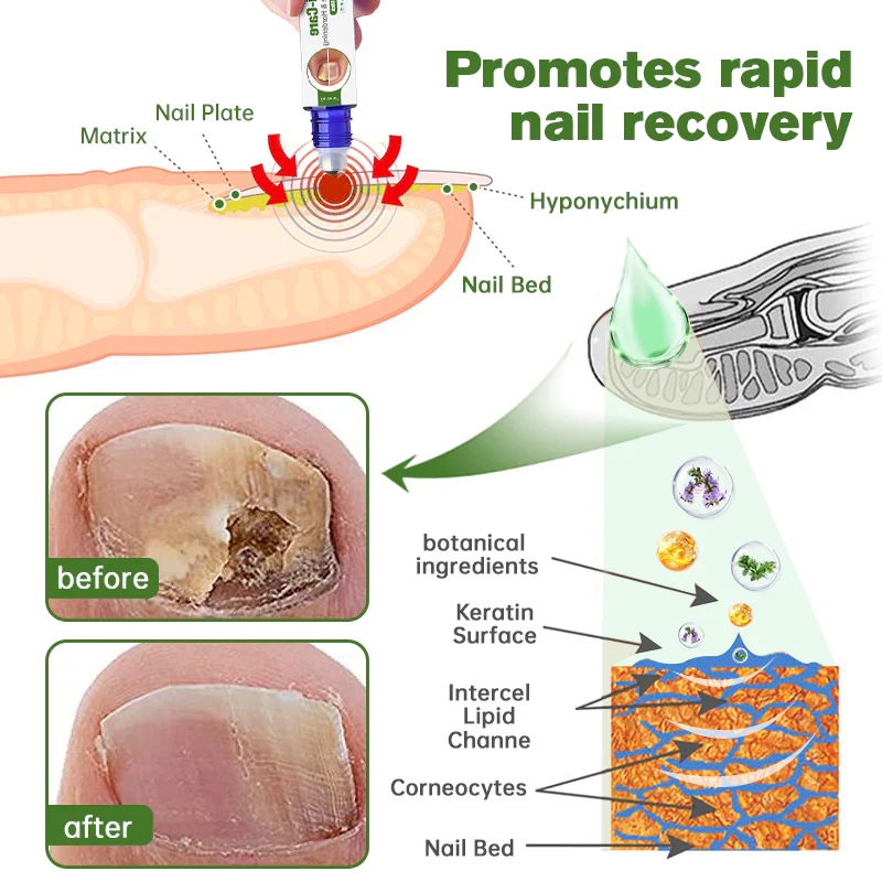Furzero™ Medi-Care Anti-Fungal Stick