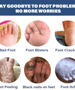 Furzero™ Medical Grade Nail Fungus Foot Strengthening Spray