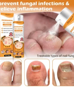 Furzero™ PsoriaHeal Bee Venom Psoriasis Treatment Spray