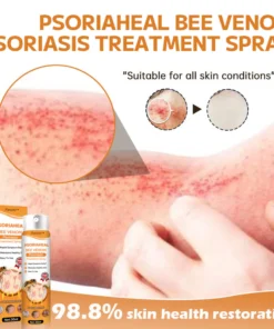 Furzero™ PsoriaHeal Bee Venom Psoriasis Treatment Spray