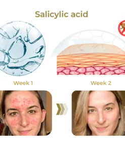 GFOUK™ AcneVe Anti-Mite Gold Foil Soap