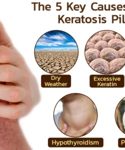 GFOUK™ Kera-Tone Bee Venom Soap