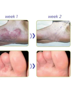 GFOUK™ PediSpa Foot Scrub Spray