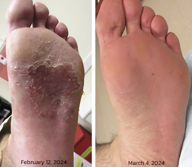 GFOUK™ PediSpa Foot Scrub Spray