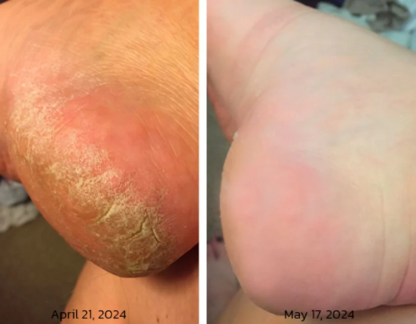 GFOUK™ PediSpa Foot Scrub Spray