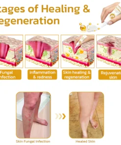 GFOUK™ PomphX Relief Cream